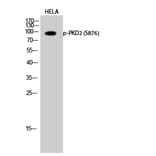 Western Blot - Anti-PKD2 (phospho Ser876) Antibody (A0808) - Antibodies.com