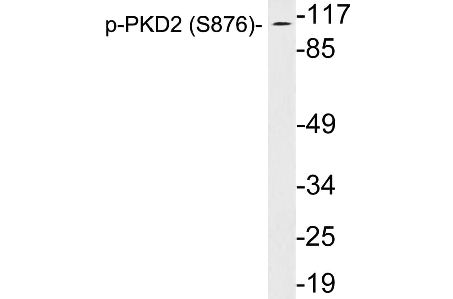Western Blot - Anti-PKD2 (phospho Ser876) Antibody (P12-1046) - Antibodies.com
