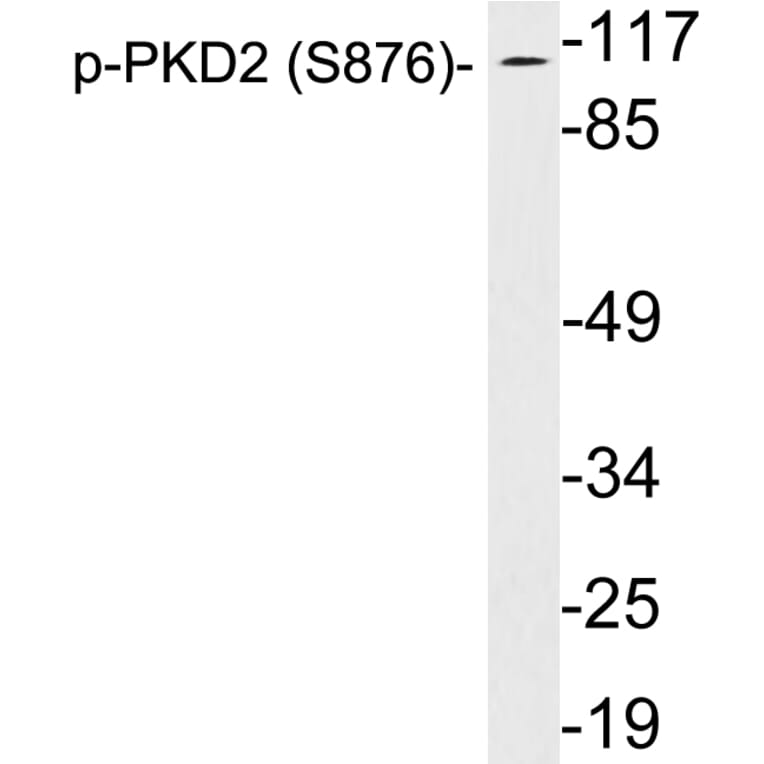 Western Blot - Anti-PKD2 (phospho Ser876) Antibody (P12-1046) - Antibodies.com