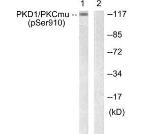 Western Blot - Anti-PKD1 (phospho Ser910) Antibody (A0721) - Antibodies.com