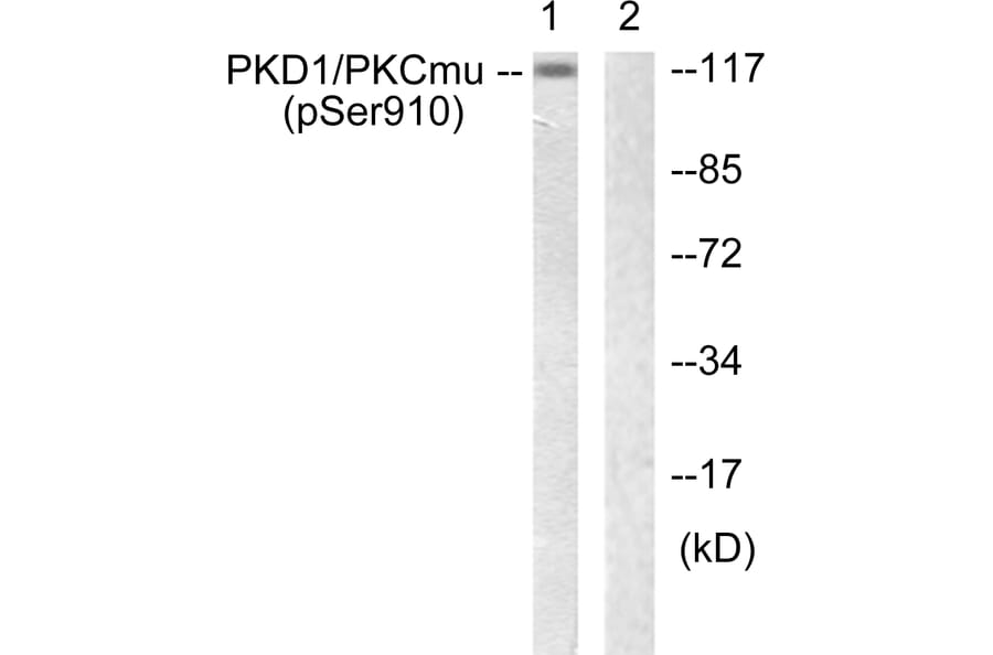 Western Blot - Anti-PKD1 (phospho Ser910) Antibody (A0721) - Antibodies.com