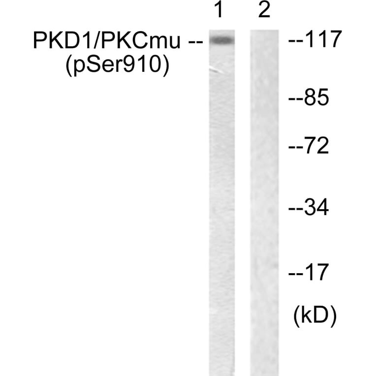 Western Blot - Anti-PKD1 (phospho Ser910) Antibody (A0721) - Antibodies.com