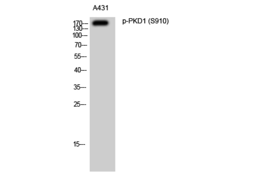 Western Blot - Anti-PKD1 (phospho Ser910) Antibody (A0721) - Antibodies.com