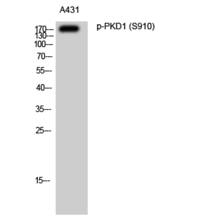 Western Blot - Anti-PKD1 (phospho Ser910) Antibody (A0721) - Antibodies.com