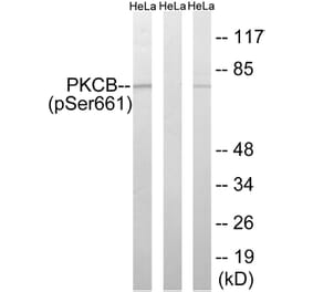 Western Blot - Anti-PKCB (phospho Ser661) Antibody (A8169) - Antibodies.com