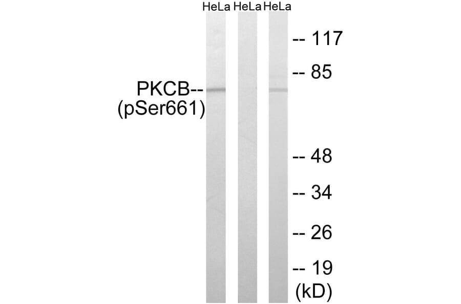 Western Blot - Anti-PKCB (phospho Ser661) Antibody (A8169) - Antibodies.com