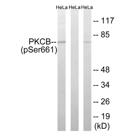 Western Blot - Anti-PKCB (phospho Ser661) Antibody (A8169) - Antibodies.com