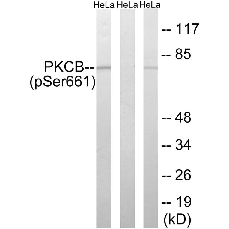 Western Blot - Anti-PKCB (phospho Ser661) Antibody (A8169) - Antibodies.com