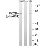 Western Blot - Anti-PKCB (phospho Ser661) Antibody (A8169) - Antibodies.com