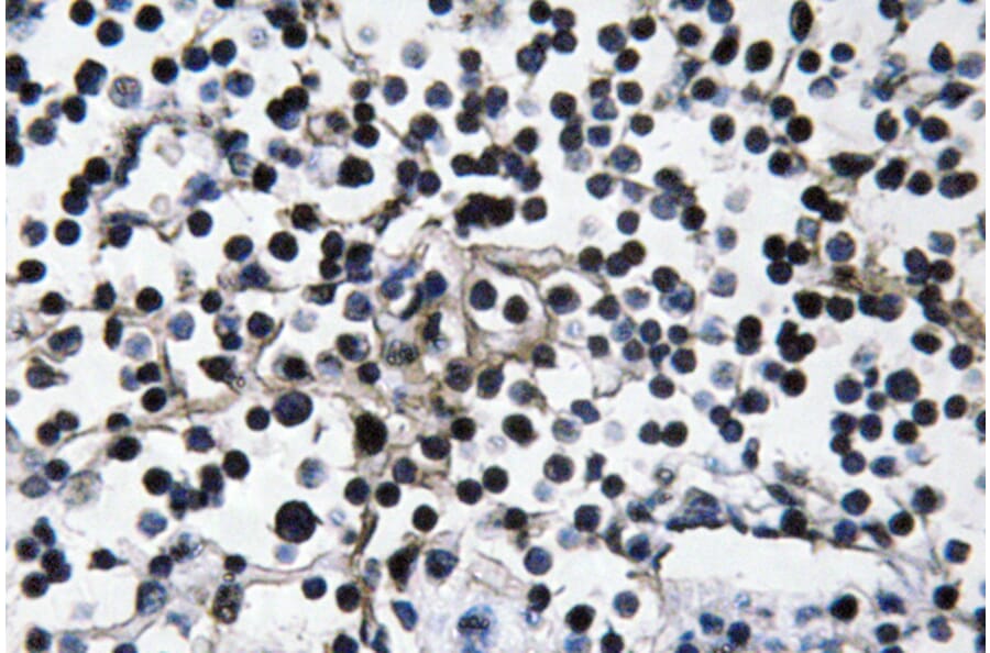 Immunohistochemistry - Anti-PI 3-kinase p110alpha Antibody (R12-2305) - Antibodies.com