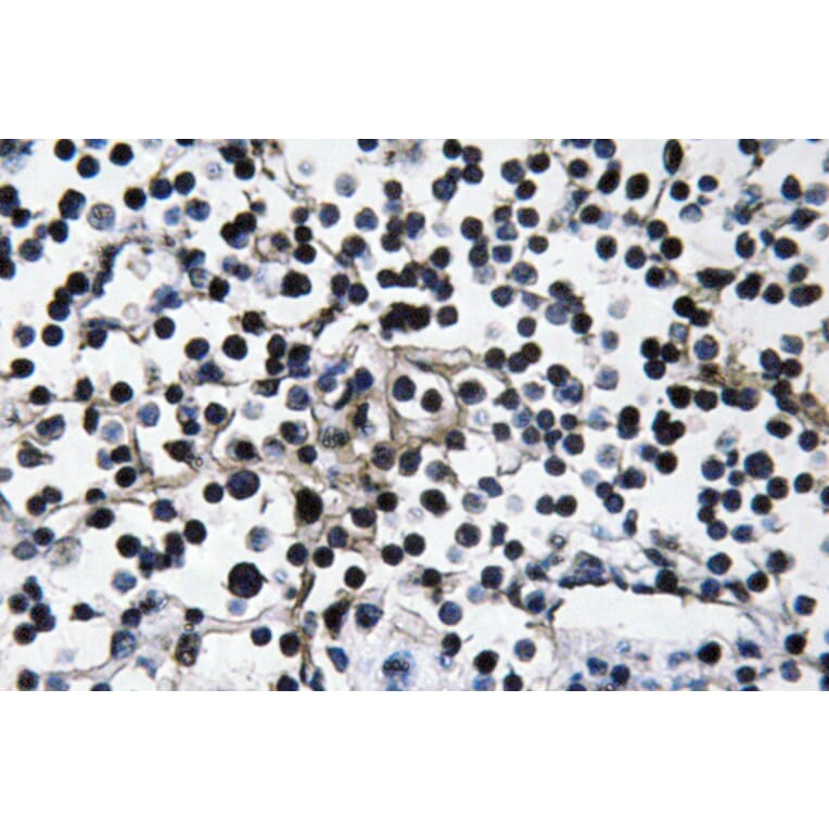 Immunohistochemistry - Anti-PI 3-kinase p110alpha Antibody (R12-2305) - Antibodies.com