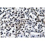 Immunohistochemistry - Anti-PI 3-kinase p110alpha Antibody (R12-2305) - Antibodies.com