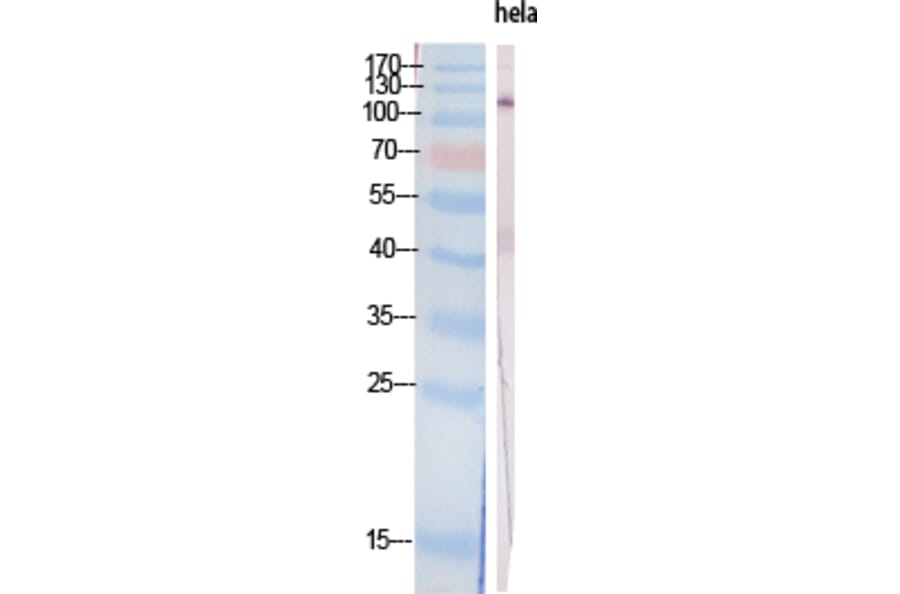 Western Blot - Anti-PI 3-kinase p110alpha Antibody (R12-2305) - Antibodies.com