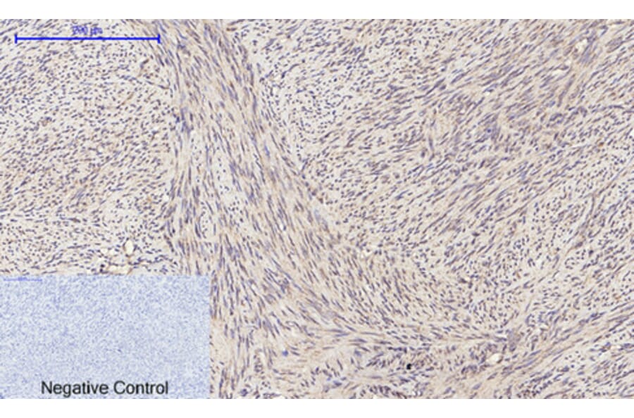 Immunohistochemistry - Anti-PI 3-kinase p110alpha Antibody (R12-2305) - Antibodies.com