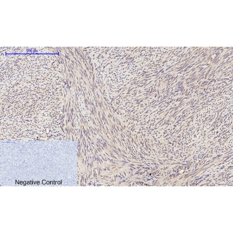 Immunohistochemistry - Anti-PI 3-kinase p110alpha Antibody (R12-2305) - Antibodies.com