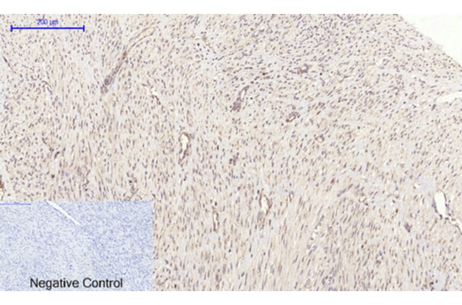 Immunohistochemistry - Anti-PI 3-kinase p110alpha Antibody (R12-2305) - Antibodies.com