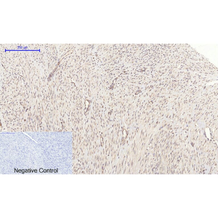 Immunohistochemistry - Anti-PI 3-kinase p110alpha Antibody (R12-2305) - Antibodies.com