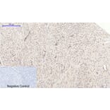 Immunohistochemistry - Anti-PI 3-kinase p110alpha Antibody (R12-2305) - Antibodies.com