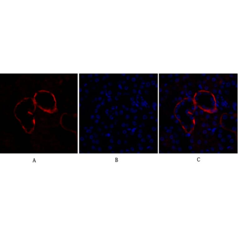 Immunofluorescence - Anti-PI 3-kinase p110alpha Antibody (R12-2305) - Antibodies.com