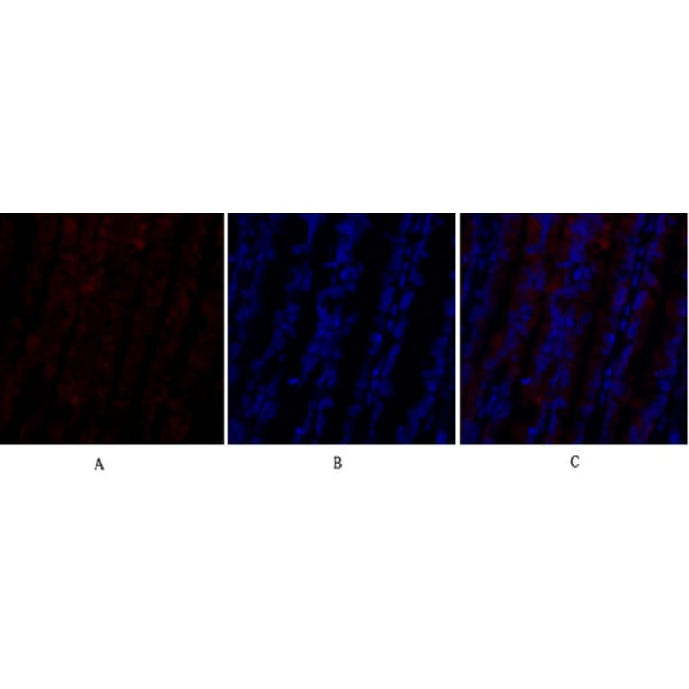 Immunofluorescence - Anti-PI 3-kinase p110alpha Antibody (R12-2305) - Antibodies.com