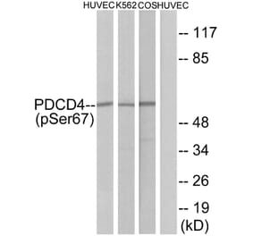 Western Blot - Anti-PDCD4 (phospho Ser67) Antibody (A1174) - Antibodies.com
