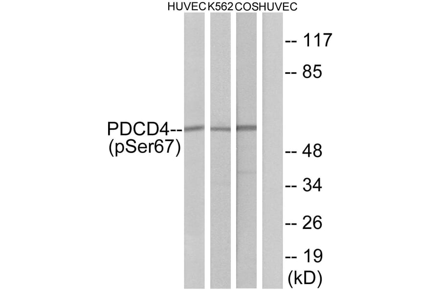 Western Blot - Anti-PDCD4 (phospho Ser67) Antibody (A1174) - Antibodies.com