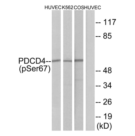 Western Blot - Anti-PDCD4 (phospho Ser67) Antibody (A1174) - Antibodies.com