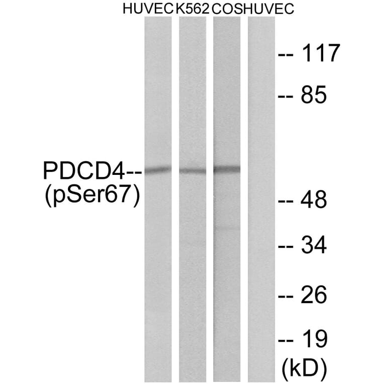 Western Blot - Anti-PDCD4 (phospho Ser67) Antibody (A1174) - Antibodies.com