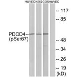 Western Blot - Anti-PDCD4 (phospho Ser67) Antibody (A1174) - Antibodies.com