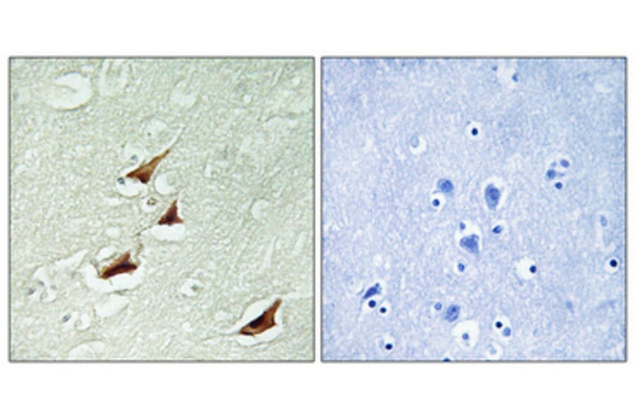 Immunohistochemistry - Anti-PDCD4 (phospho Ser67) Antibody (A1174) - Antibodies.com
