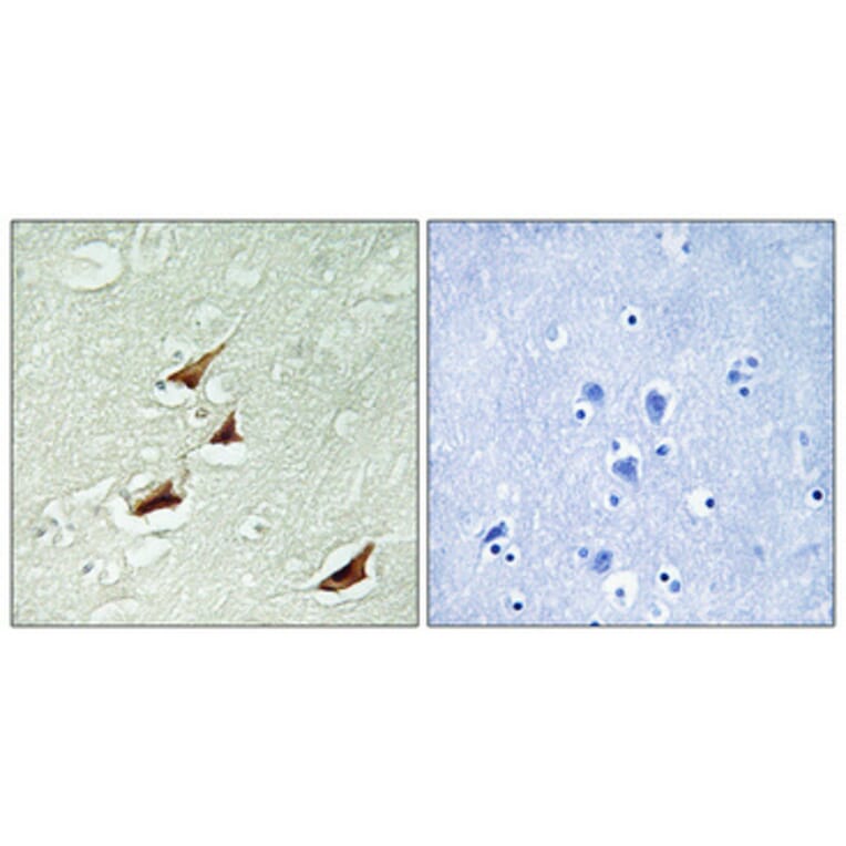 Immunohistochemistry - Anti-PDCD4 (phospho Ser67) Antibody (A1174) - Antibodies.com