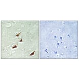 Immunohistochemistry - Anti-PDCD4 (phospho Ser67) Antibody (A1174) - Antibodies.com