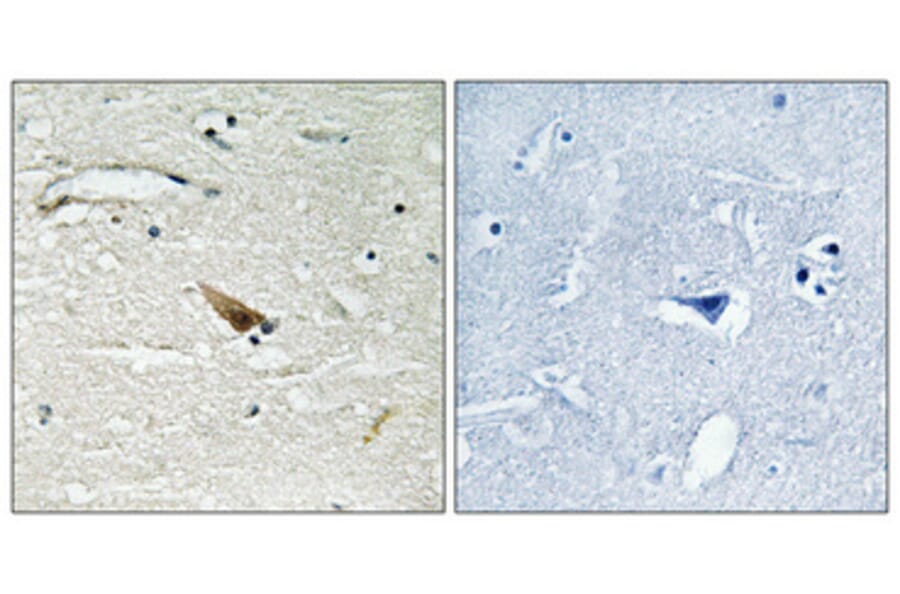 Immunohistochemistry - Anti-PDCD4 (phospho Ser67) Antibody (A1174) - Antibodies.com