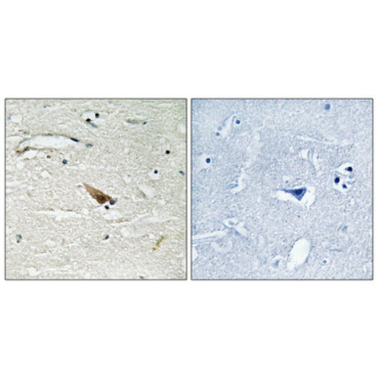 Immunohistochemistry - Anti-PDCD4 (phospho Ser67) Antibody (A1174) - Antibodies.com