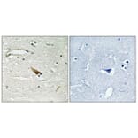 Immunohistochemistry - Anti-PDCD4 (phospho Ser67) Antibody (A1174) - Antibodies.com