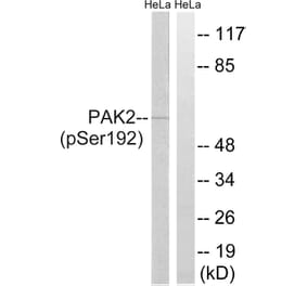 Western Blot - Anti-PAK2 (phospho Ser192) Antibody (A8160) - Antibodies.com