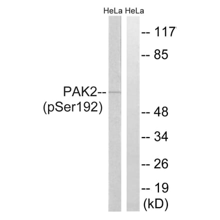Western Blot - Anti-PAK2 (phospho Ser192) Antibody (A8160) - Antibodies.com