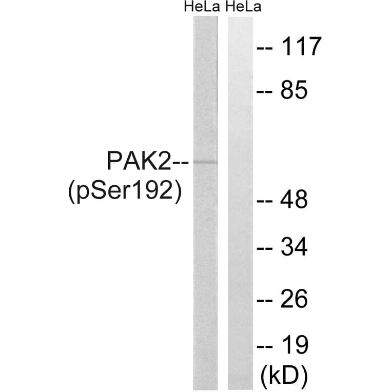 Western Blot - Anti-PAK2 (phospho Ser192) Antibody (A8160) - Antibodies.com