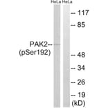 Western Blot - Anti-PAK2 (phospho Ser192) Antibody (A8160) - Antibodies.com