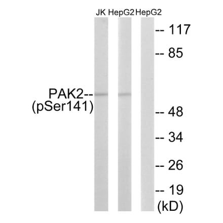 Western Blot - Anti-PAK2 (phospho Ser141) Antibody (A8161) - Antibodies.com