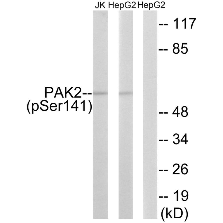 Western Blot - Anti-PAK2 (phospho Ser141) Antibody (A8161) - Antibodies.com