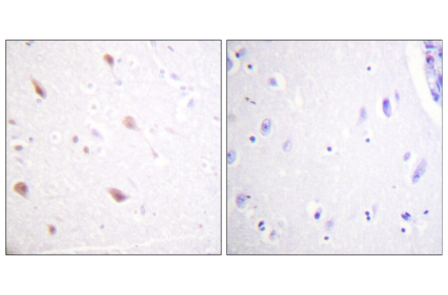 Immunohistochemistry - Anti-NIFK (phospho Thr234) Antibody (A1106) - Antibodies.com