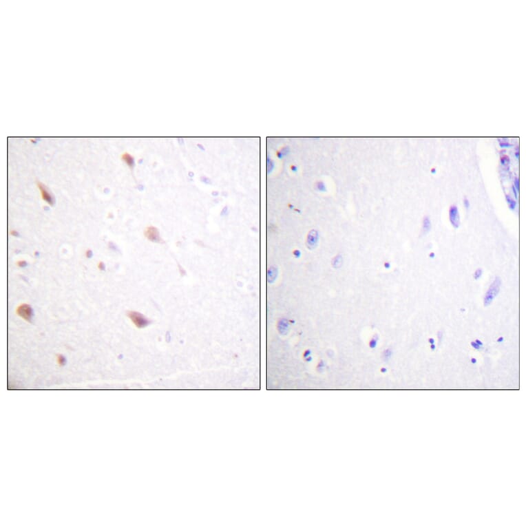 Immunohistochemistry - Anti-NIFK (phospho Thr234) Antibody (A1106) - Antibodies.com