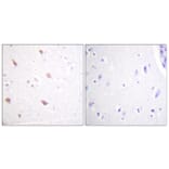 Immunohistochemistry - Anti-NIFK (phospho Thr234) Antibody (A1106) - Antibodies.com