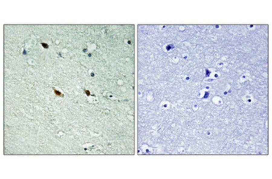Immunohistochemistry - Anti-NIFK (phospho Thr234) Antibody (A1106) - Antibodies.com