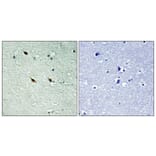 Immunohistochemistry - Anti-NIFK (phospho Thr234) Antibody (A1106) - Antibodies.com