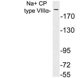 Western Blot - Anti-Na+ CP type VIIIalpha Antibody (R12-2250) - Antibodies.com