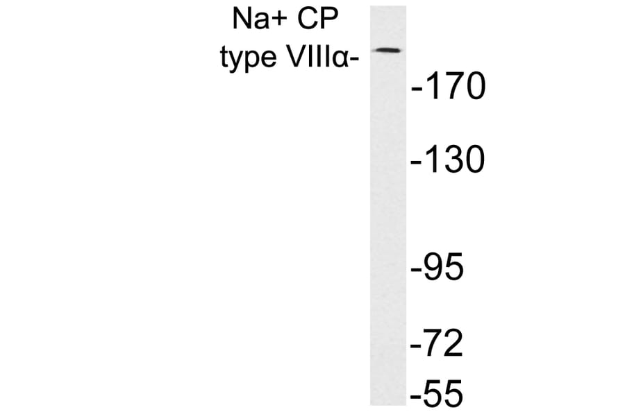 Western Blot - Anti-Na+ CP type VIIIalpha Antibody (R12-2250) - Antibodies.com