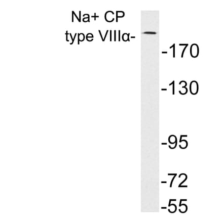 Western Blot - Anti-Na+ CP type VIIIalpha Antibody (R12-2250) - Antibodies.com