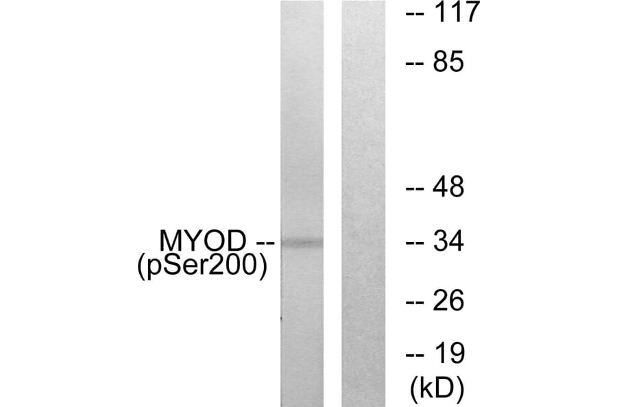 Western Blot - Anti-MYOD (phospho Ser200) Antibody (A0516) - Antibodies.com